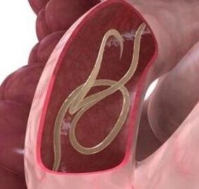 Roundworms are common in the human intestine. 