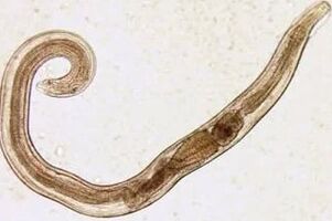 Parasites of a man wound