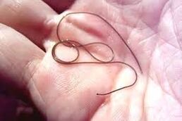 Parasites in the palm of your hand