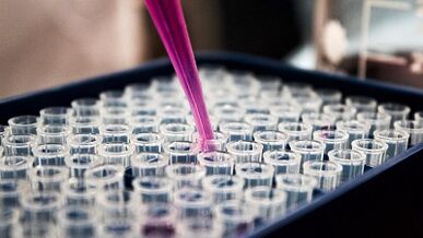 How to take a test to detect parasites in the body